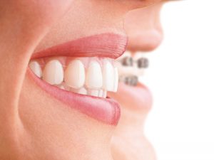 studio smiles alpignano ortodonzia